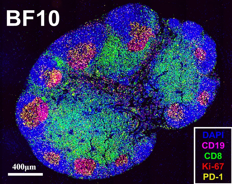 NYCU Reveals Breakthrough Fusion Protein Drug with Potential for Cancer ...